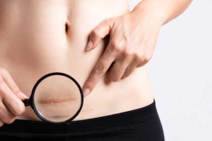 Žiadny názov projektu (46) Easy Resize.com