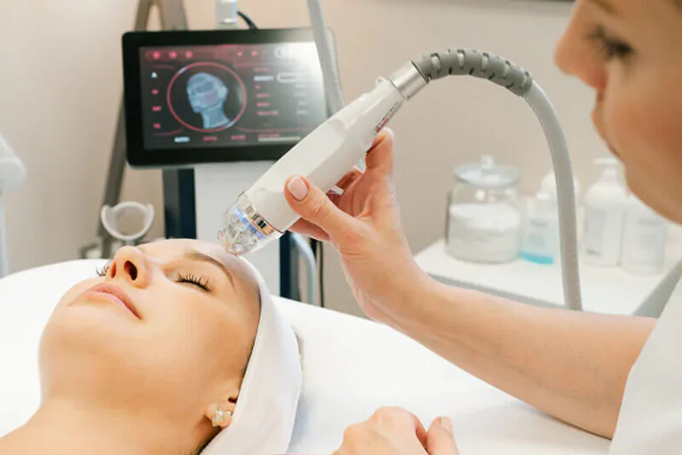 Rádiorefrakčný mikroihlový Rf lifting bez skalpela